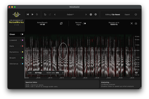 NoiseWorks VoiceAssist Advanced